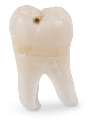 tooth decay preventing