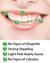 What+healthy+gums+look+like