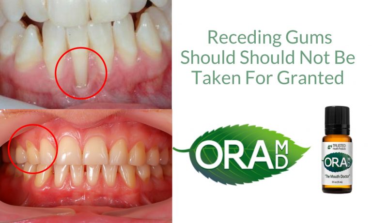 Receding Gums Treatment - OraMD Blog